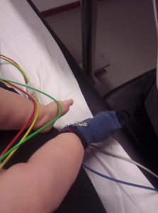 De schrik van mijn leven baby ziekenhuis epilepsie aanval